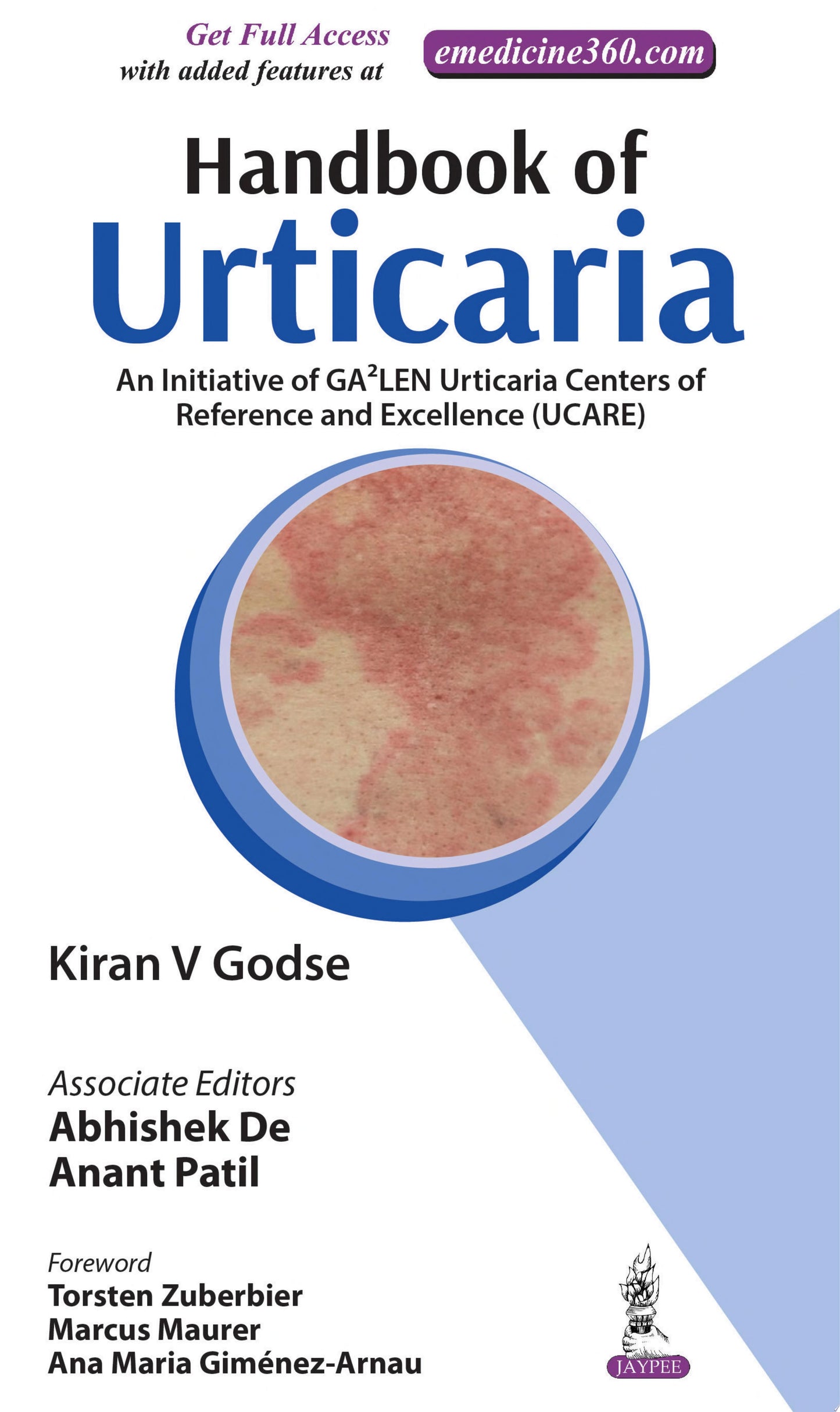 Handbook of Urticaria