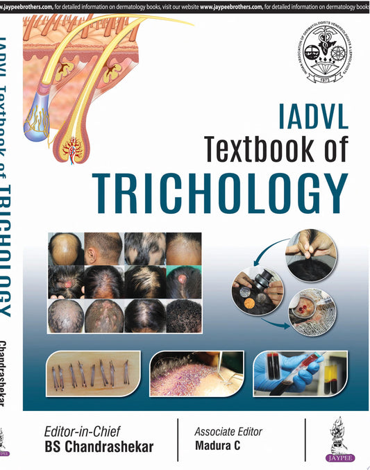 IADVL Textbook of Trichology