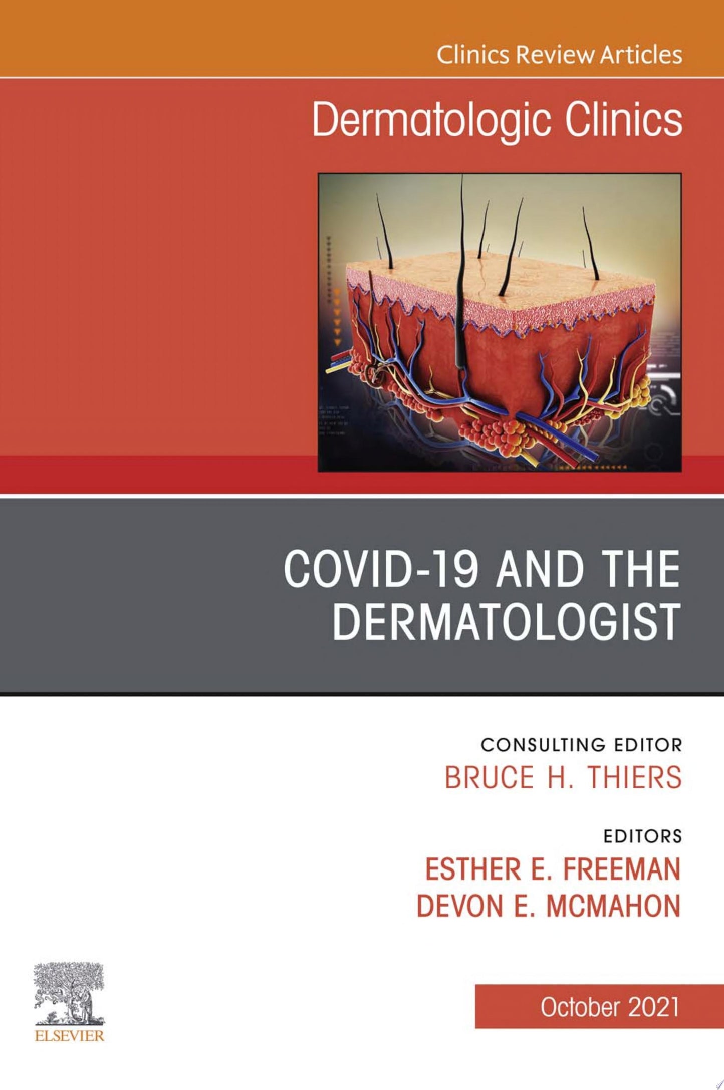 Rosacea, An Issue of Dermatologic Clinics, E-Book