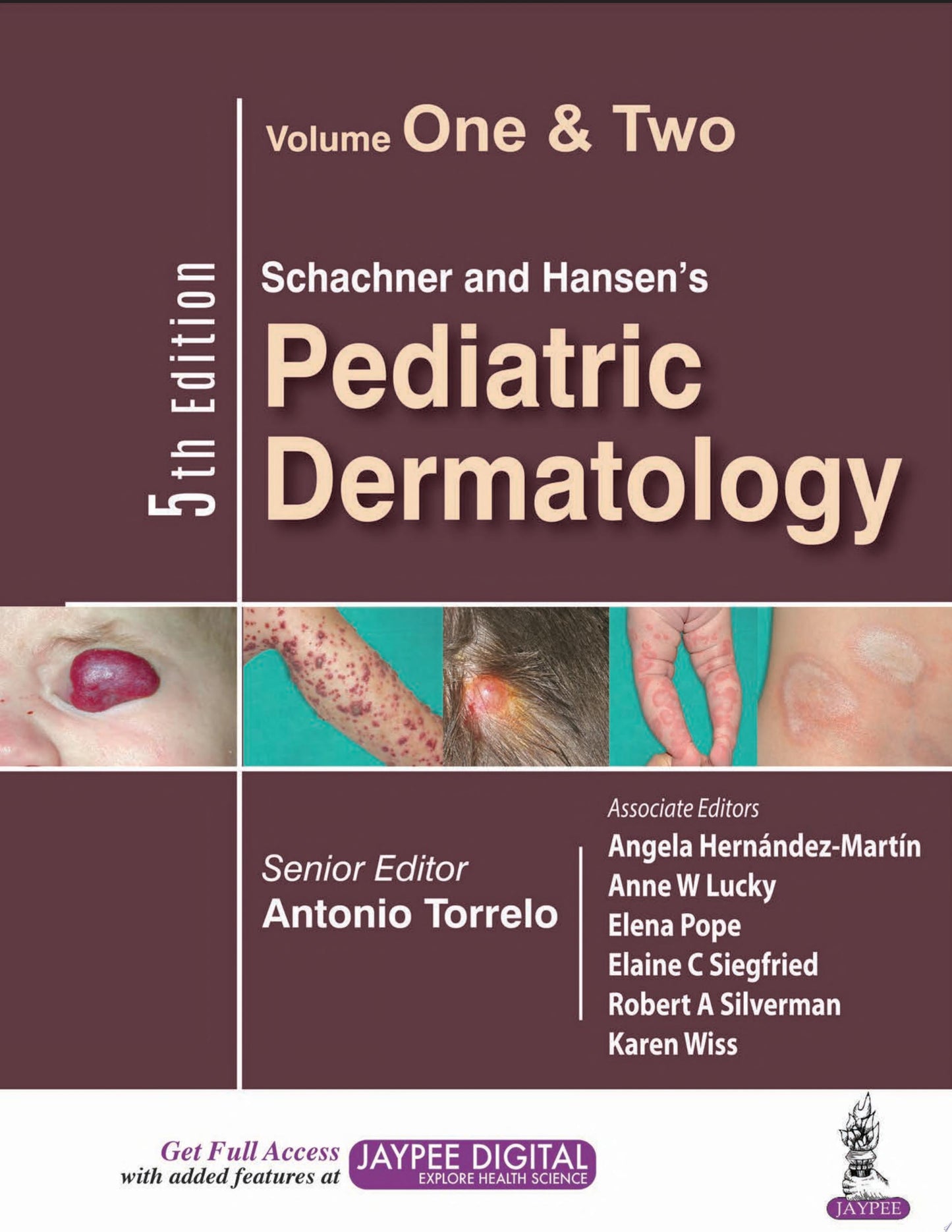 Dermoscopy in General Dermatology