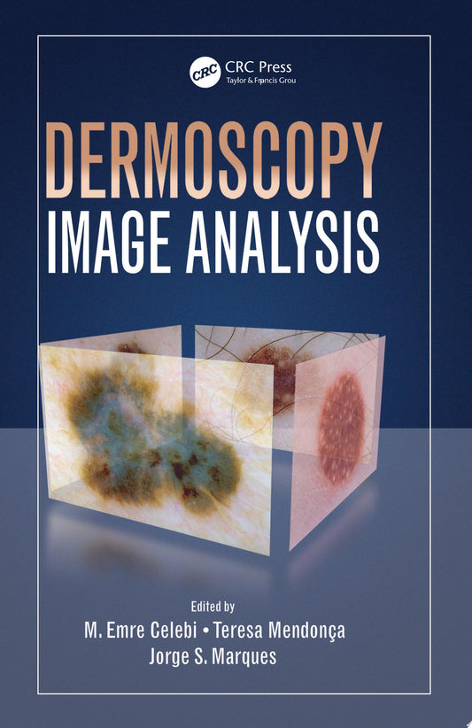 Dermoscopy Image Analysis
