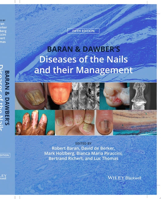 Baran and Dawber’s Diseases of the Nails and their Management, 5ed
