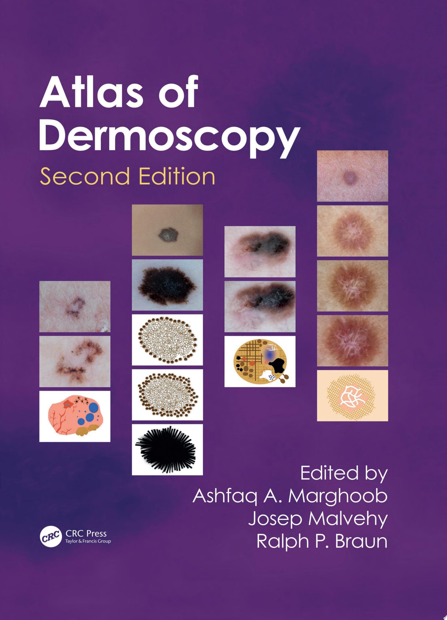 An Atlas of Dermoscopy, 2nd Edition