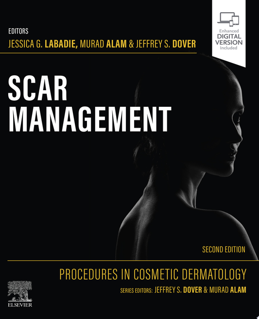 Acne Scars: Classification and Treatment, 2ed