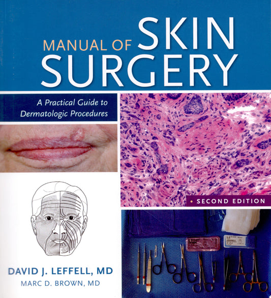 Manual of Skin Surgery: A Practical Guide to Dermatologic Procedures