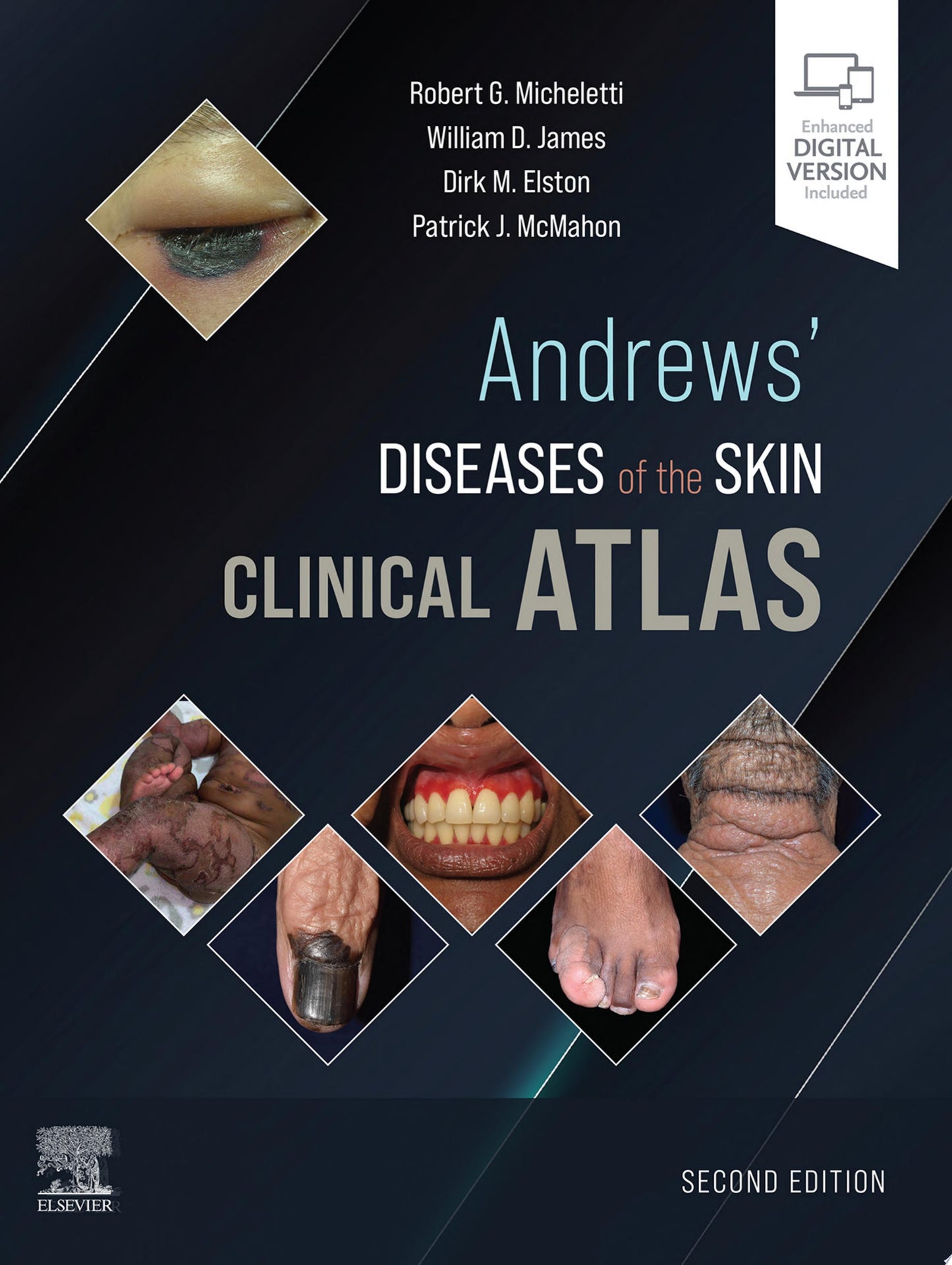 Andrews’ Diseases of the Skin Clinical Atlas, 2nd edition
