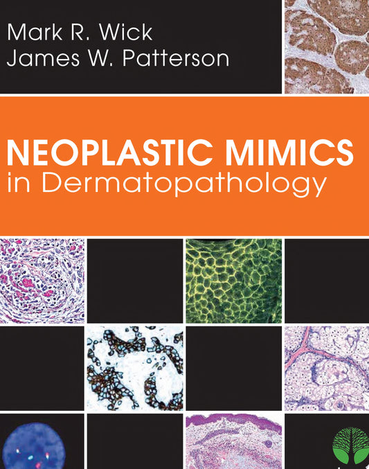 Neoplastic Mimics in Dermatopathology