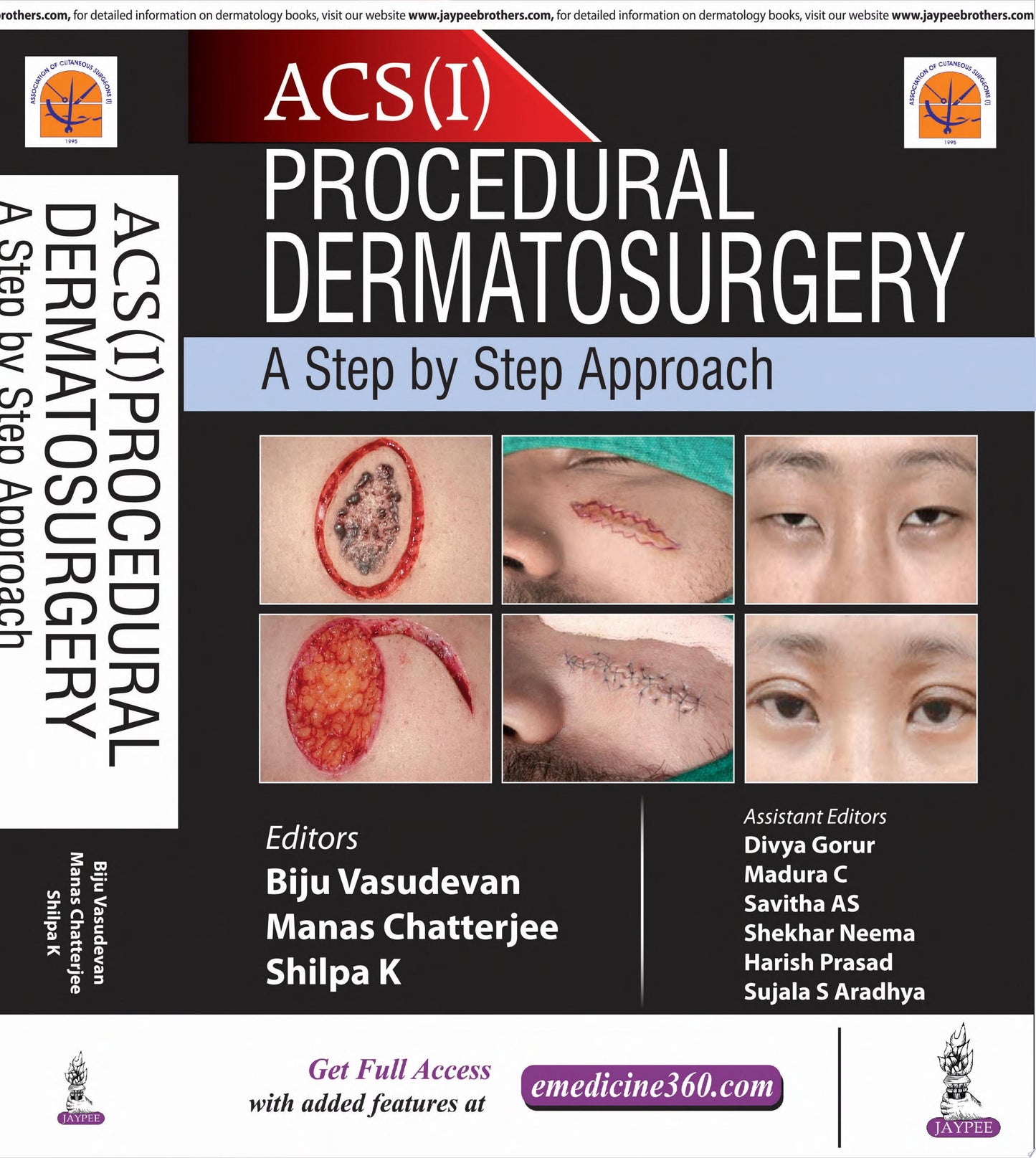 Procedural Dermatosurgery: A Step by Step Approach