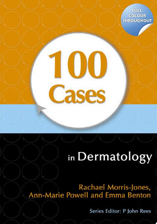 100 Cases in Dermatology