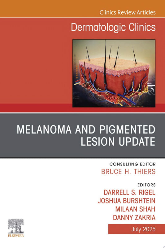 Melanoma and Pigmented Lesion Update, An Issue of Dermatologic Clinics