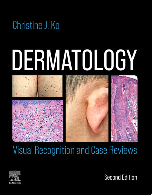 Dermatology: Visual Recognition and Case Reviews, 2nd edition