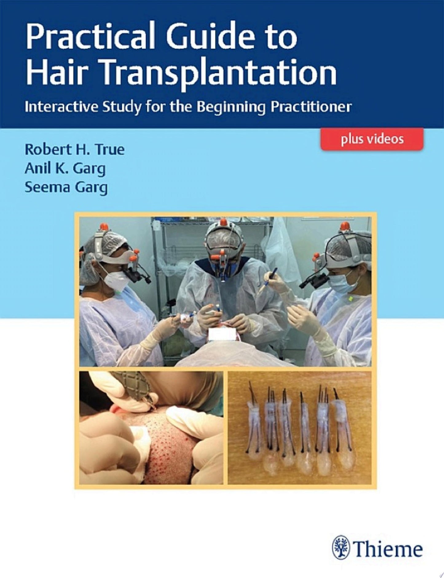 Hair Transplantation, 5ed
