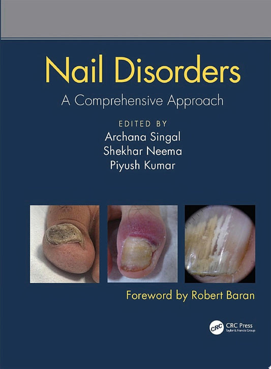 Nail Disorders: A Comprehensive Approach