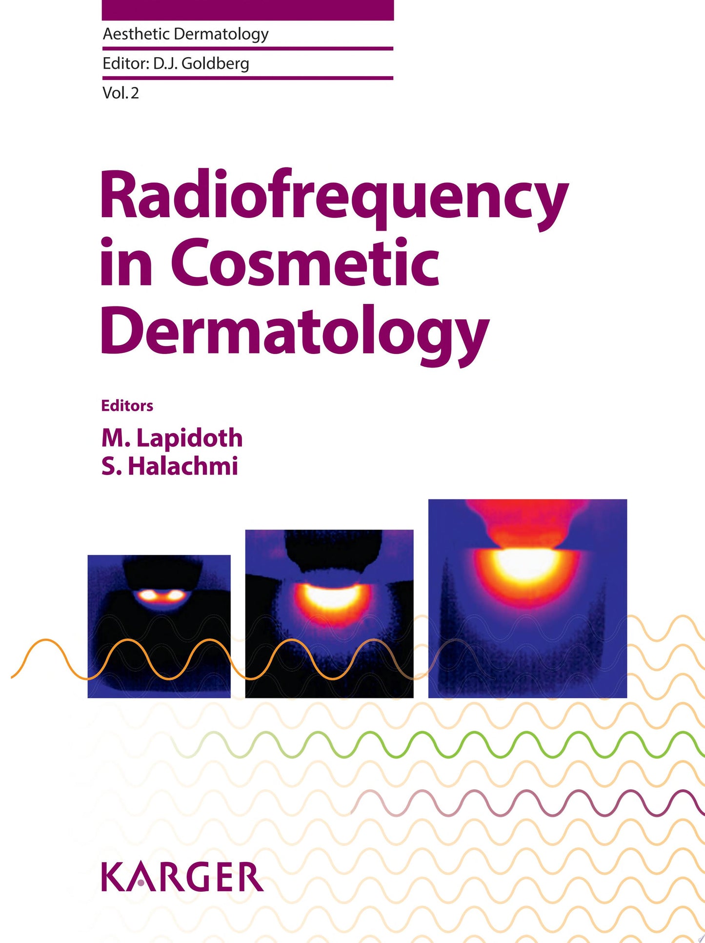 Radiofrequency in Cosmetic Dermatology