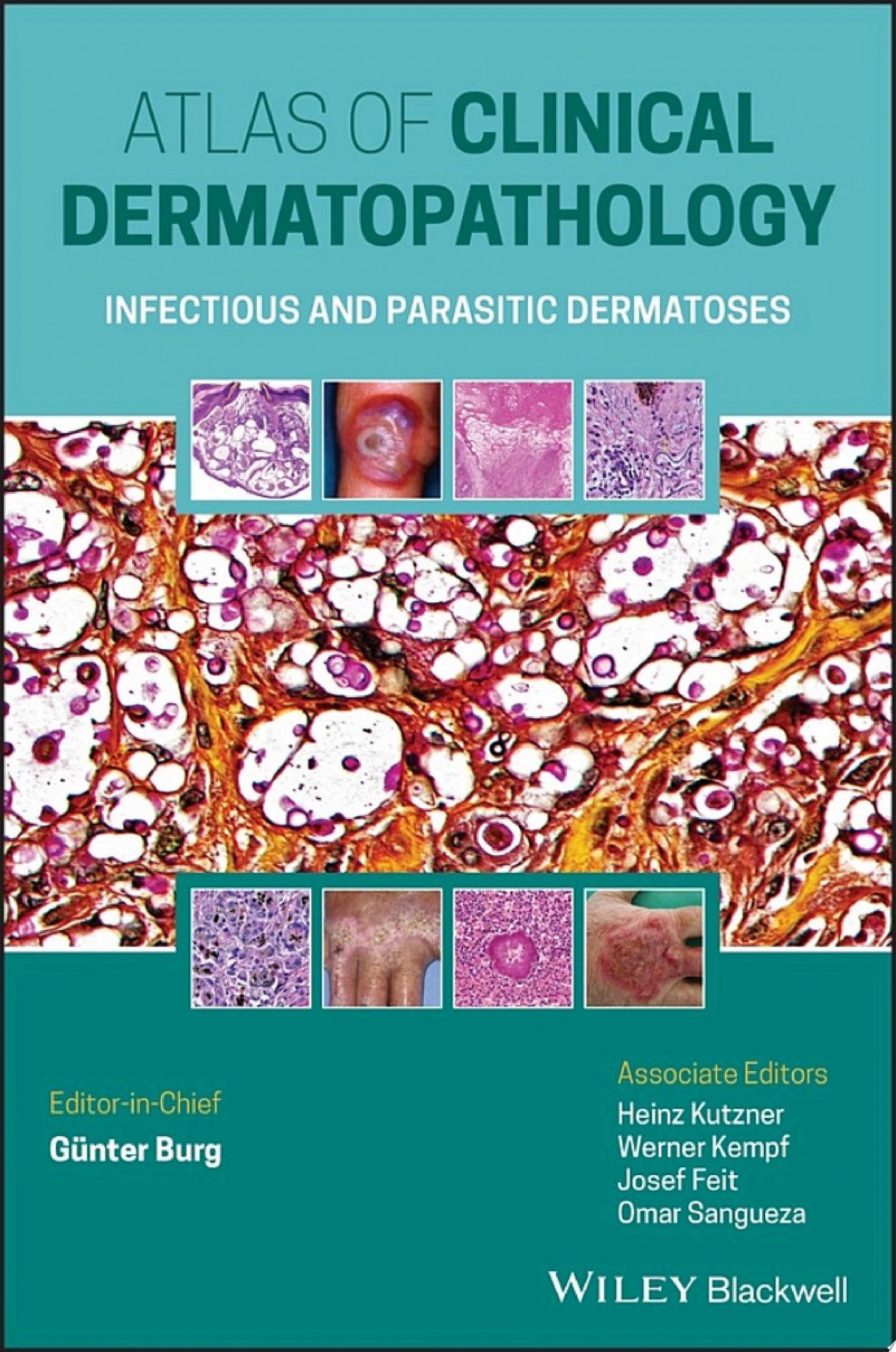 Atlas of Clinical Dermatopathology: Infectious and Parasitic Dermatoses