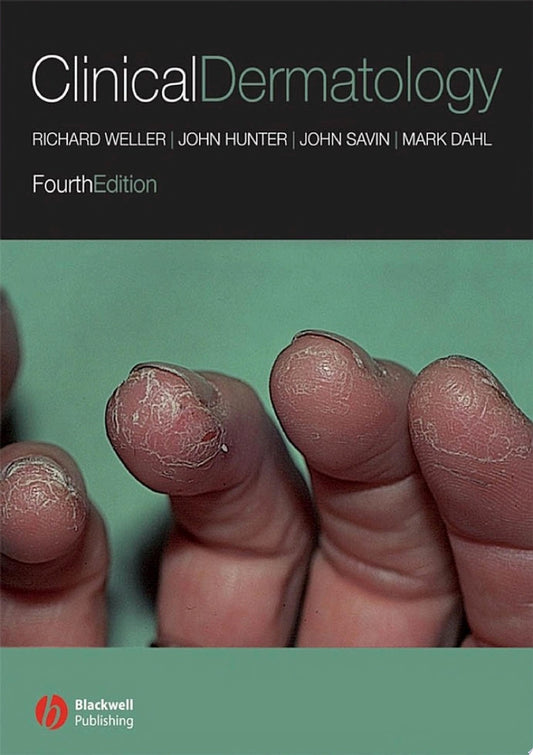 Clinical Dermatology, 5th Edition