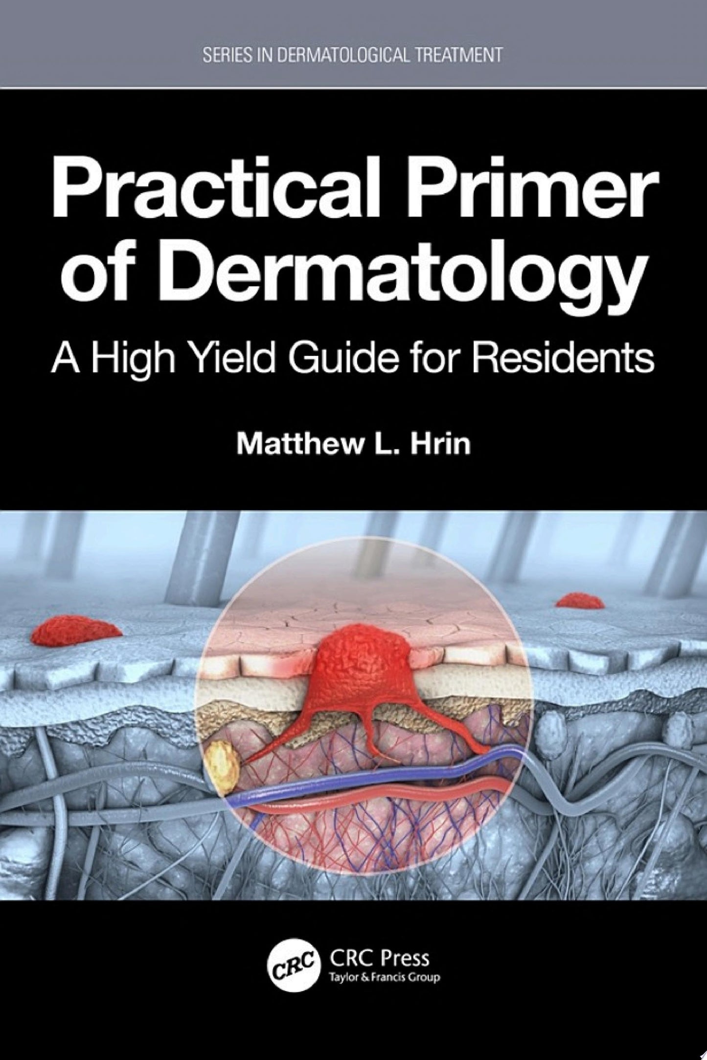 Practical Primer of Dermatology: A High Yield Guide for Residents