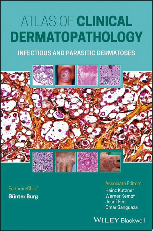 Atlas Clinical of Dermatopathology: Infectious and Parasitic Dermatoses