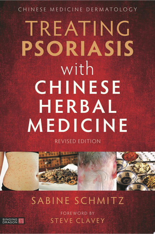 Treating Psoriasis with Chinese Herbal Medicine: A Practical Handbook