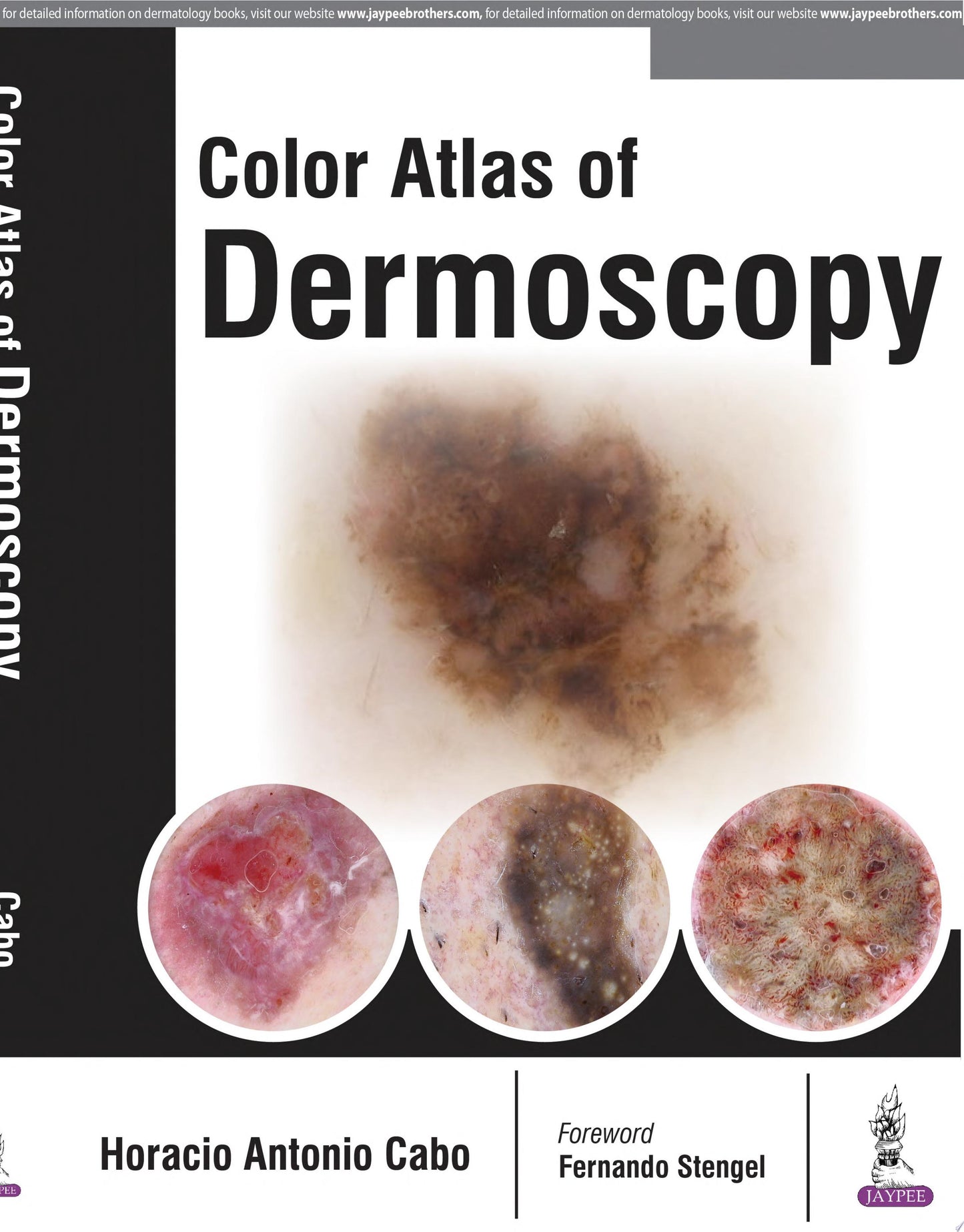 Color Atlas of Dermoscopy