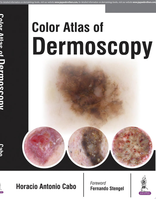 Color Atlas of Dermoscopy