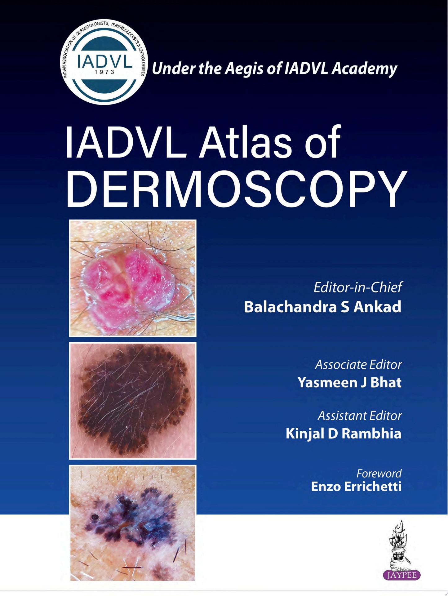 IADVL Atlas of Dermoscopy