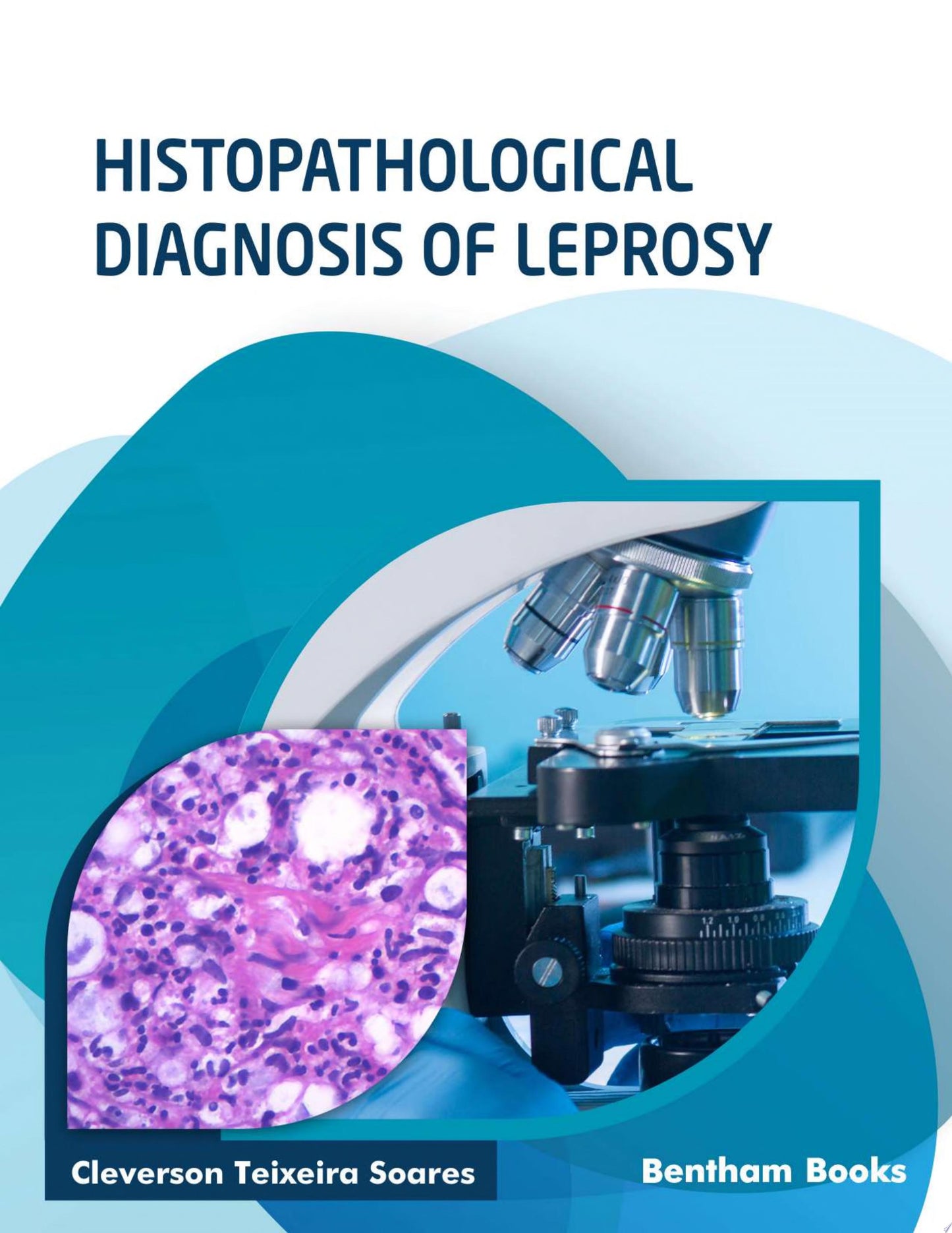 Histopathological Diagnosis Of Leprosy