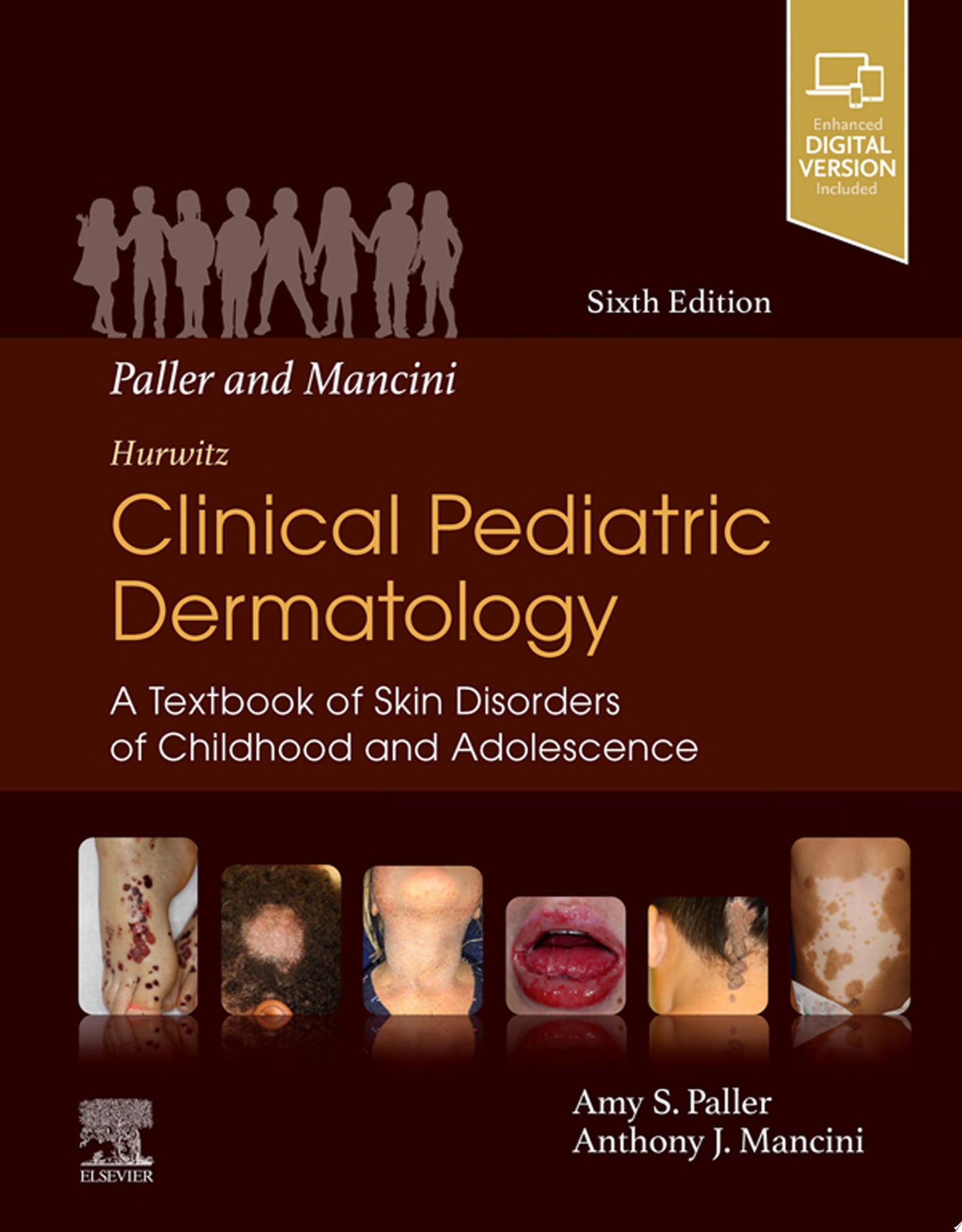 Hurwitz Clinical Pediatric Dermatology, 4th Edition