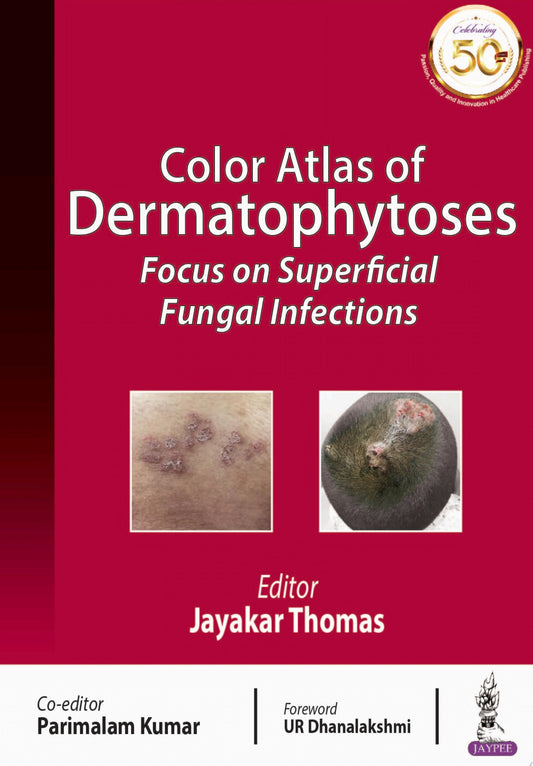 Color Atlas of Dermatophytoses: Focus on Superficial Fungal Infections