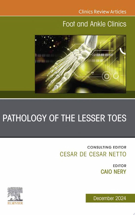 Pathology of the Lesser Toes, An issue of Foot and Ankle Clinics of North America