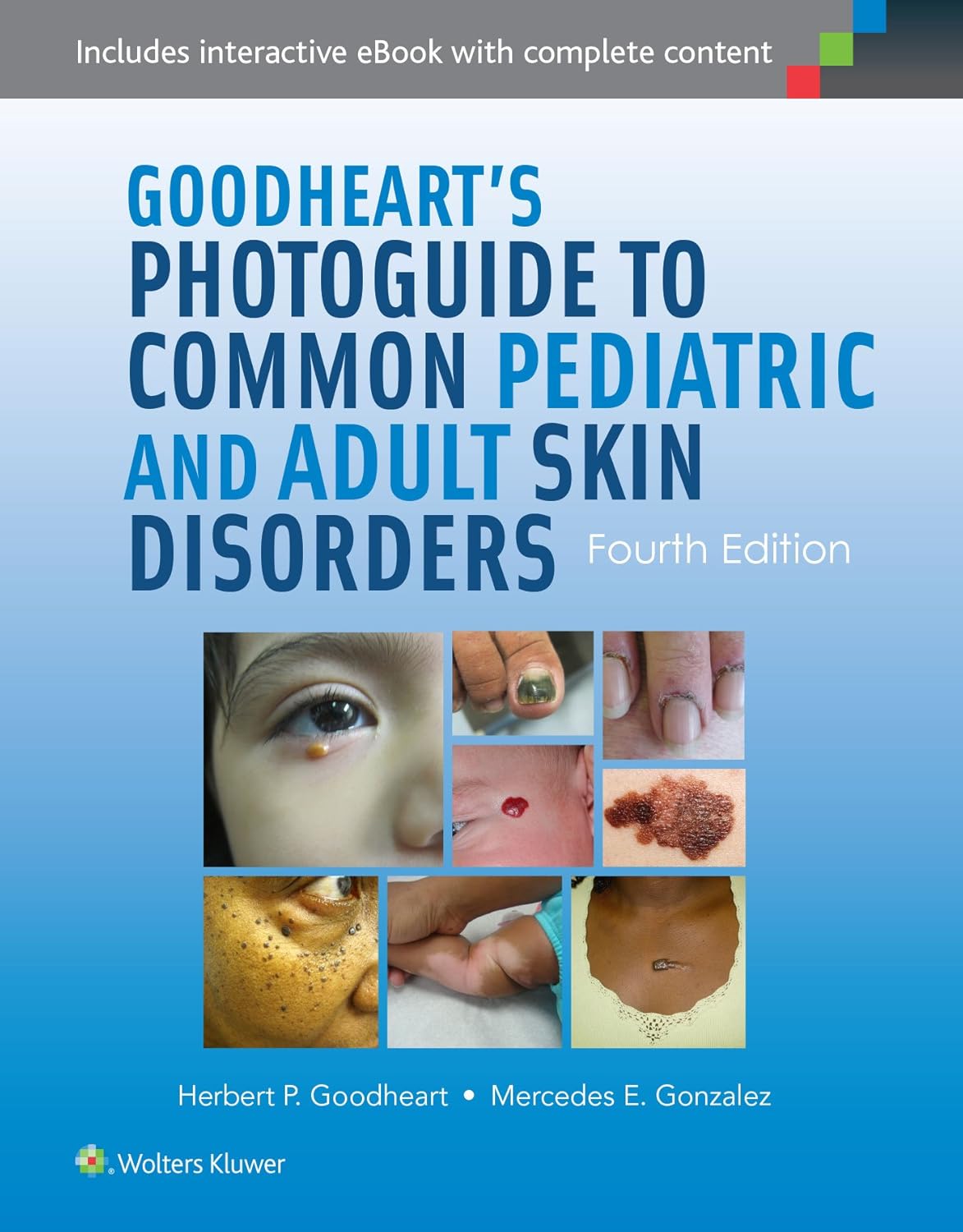 Goodheart’s Photoguide to Common Pediatric and Adult Skin Disorders, Fourth Edition
