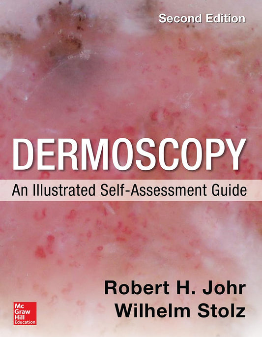 Dermoscopy: An Illustrated Self-Assessment Guide, 2nd Edition